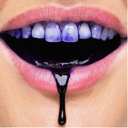 Natūrali šypsena kiekvieną dieną: HiSmile dantų balinimo serumas 