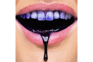 Natūrali šypsena kiekvieną dieną: HiSmile dantų balinimo serumas