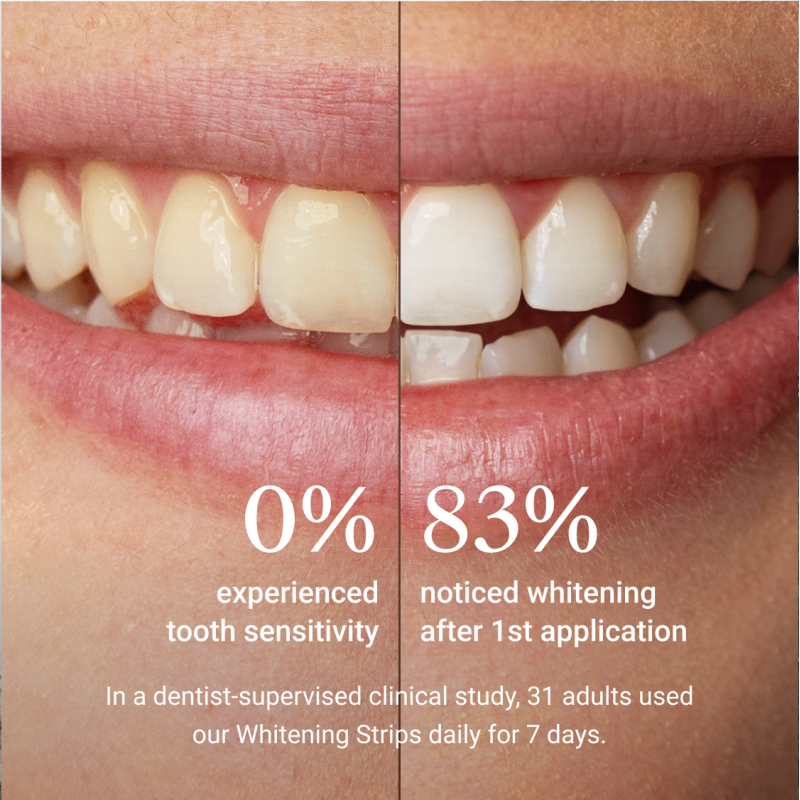 Whitening Strips Balinančios dantų juostelės, 7 poros
