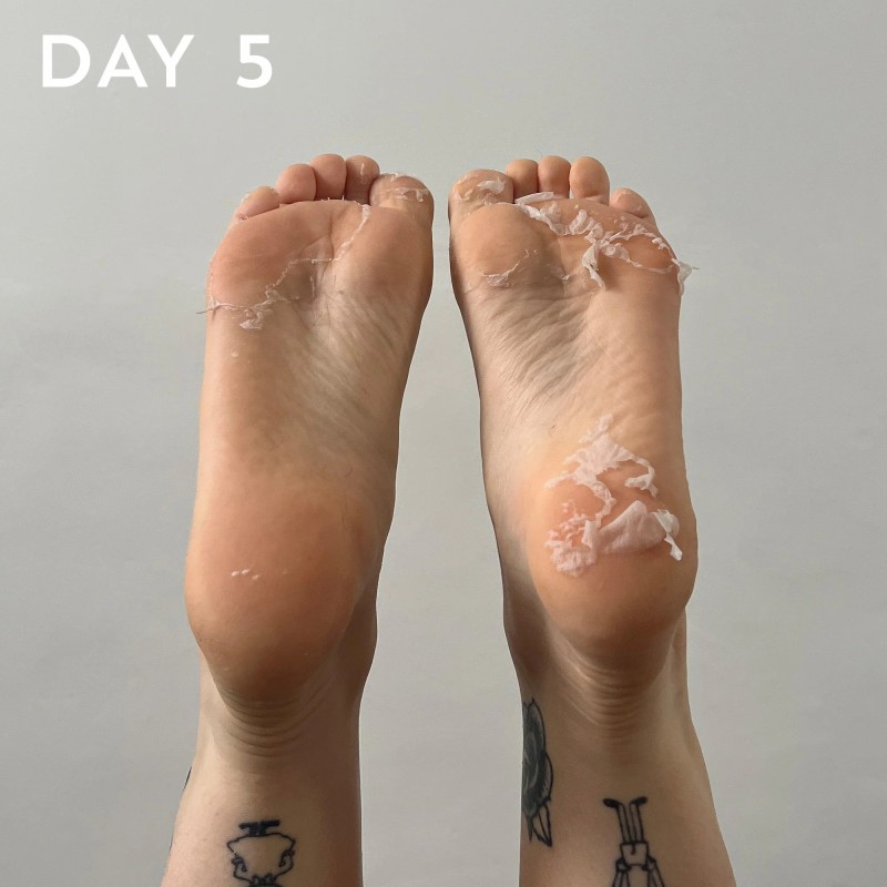 FOOT PEEL Professional Foot Treatment Nulupamoji pėdų kaukė-kojinės, 1 pora