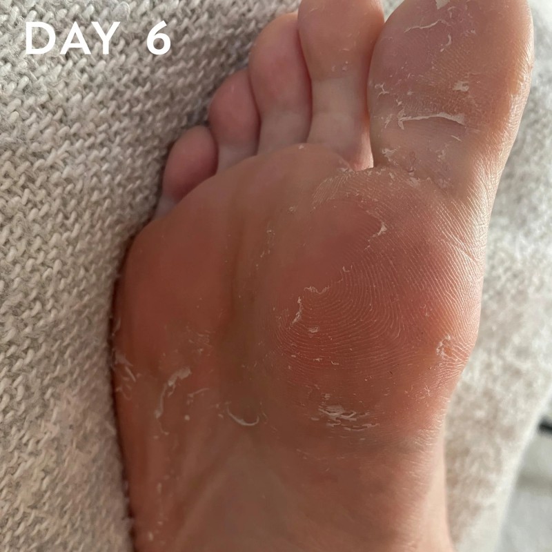 FOOT PEEL Professional Foot Treatment Nulupamoji pėdų kaukė-kojinės, 1 pora